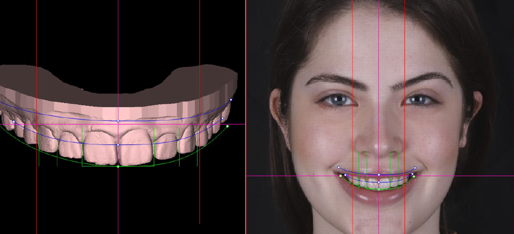 Dental Digital Smile Design Dental