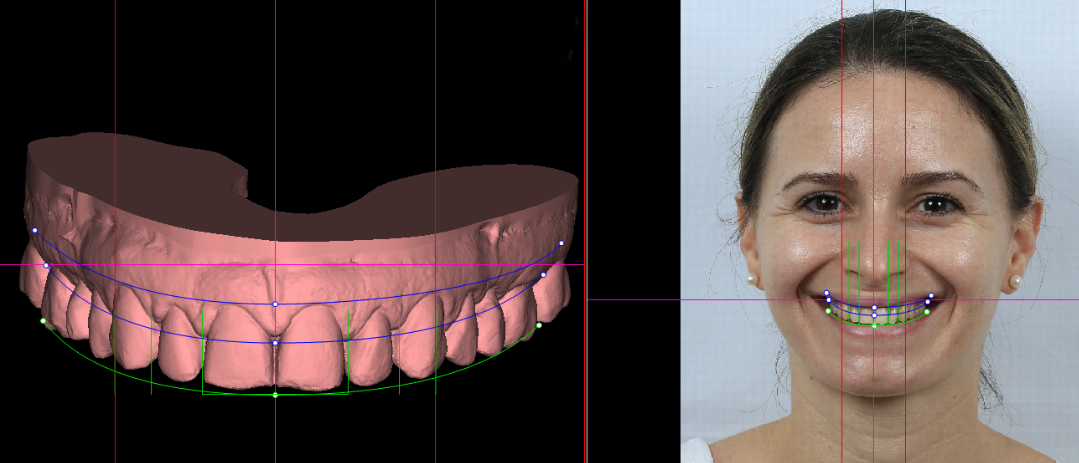 Digital Smile Design Dental Imaging Technology