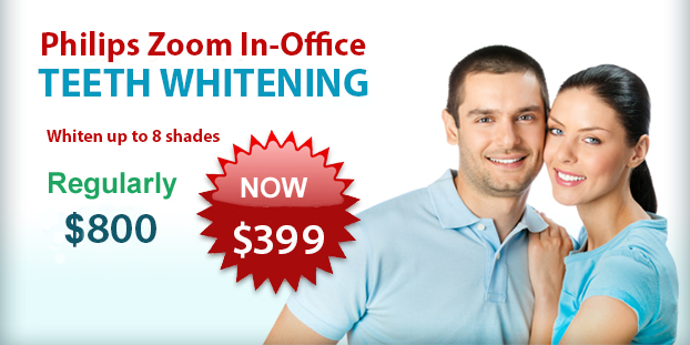 In-Office Teeth Whitening Offer