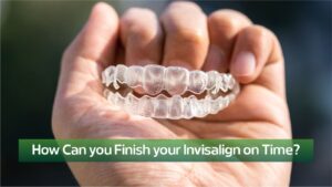 Invisalign Clear Braces invisalign dublin